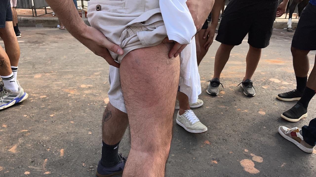 Torcedor do Cruzeiro mostrou marcas de agressão de PM (foto: Pedro Bueno/No Ataque)