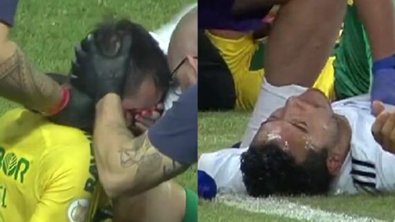 Uendel e William se machucaram em Cuiabá x Cruzeiro (foto: Reprodução/Premiere)