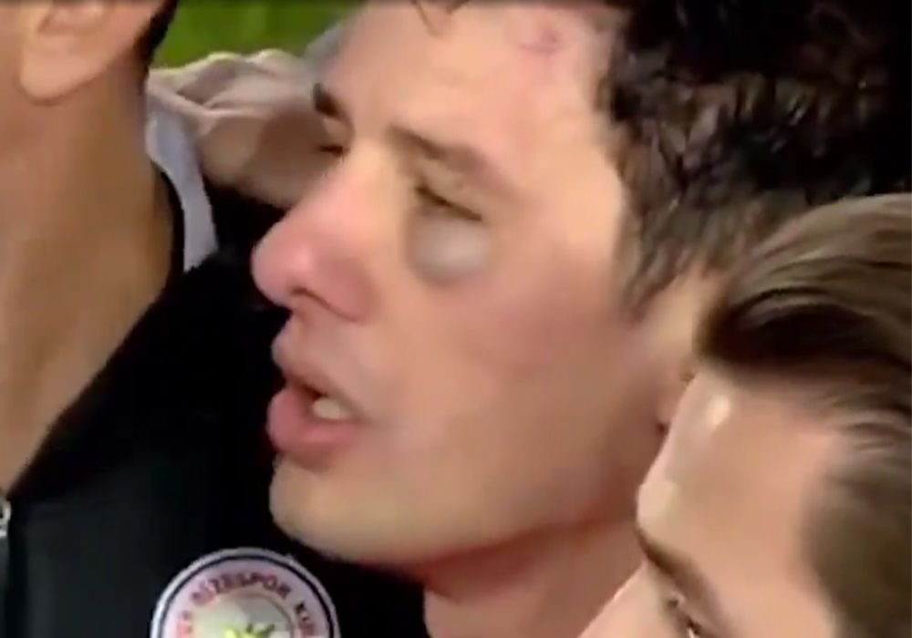 Juiz no Campeonato Turco (foto: Reprodução)