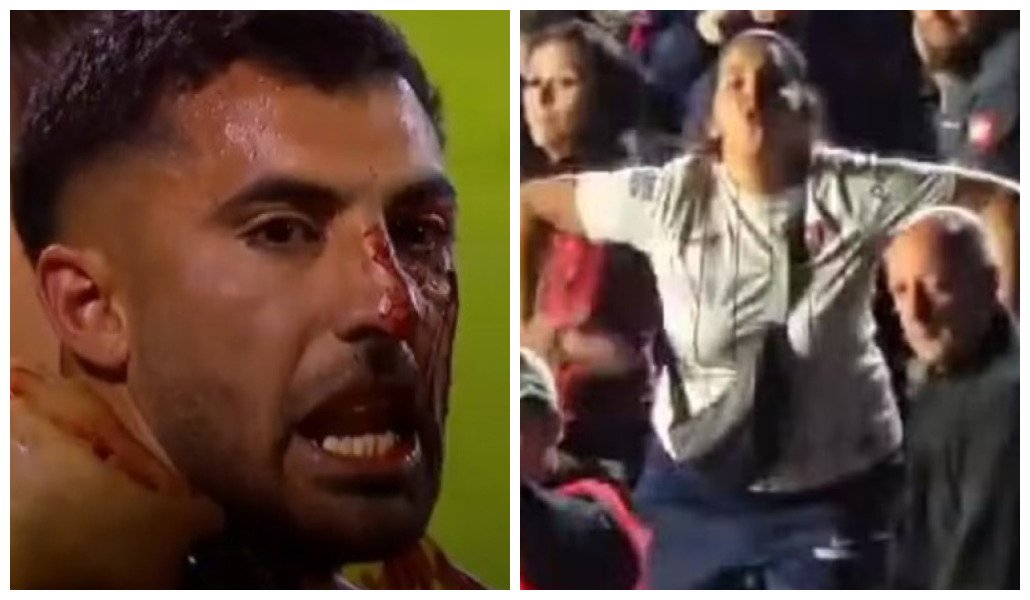 Maximiliano Oliveira foi atingido por pedra atirada por torcida do Rosario Central; torcedora do San Lorenzo imita macaco para palmeirenses (foto: Reprodução)