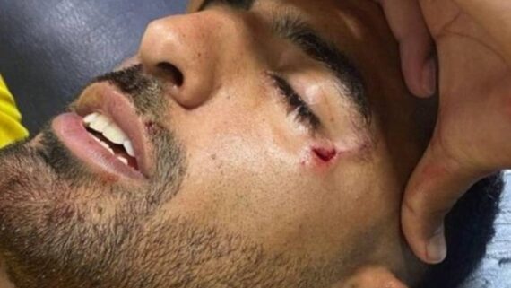 Maximiliano Oliveira teve ferimento abaixo do olho por causa da pedra atirada da torcida do Rosario Central (foto: Reprodução/Instagram)