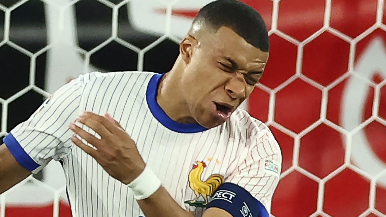 Mbappé com nariz quebrado (foto: FRANCK FIFE / AFP)