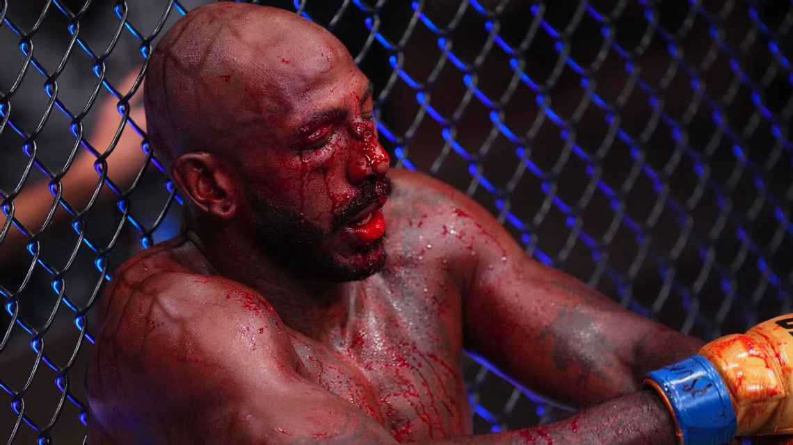 Rosto de Rountree após a luta contra o brasileiro Alex Poatan - (foto: Jeff Bottari/Zuffa LLC/UFC)