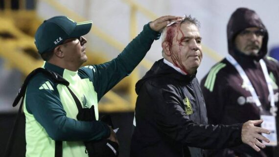 Javier Aguirre, técnico da seleção mexicana, foi atingido por uma garrafa no estádio Francisco Morazán, na cidade hondurenha de San Pedro Sula (foto: Jhony Magallanes/AFP)