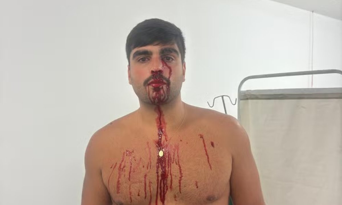 Gustavo Braga, torcedor do Flamengo atingido por fogos de artifício (foto: Reprodução/Arquivo pessoal)