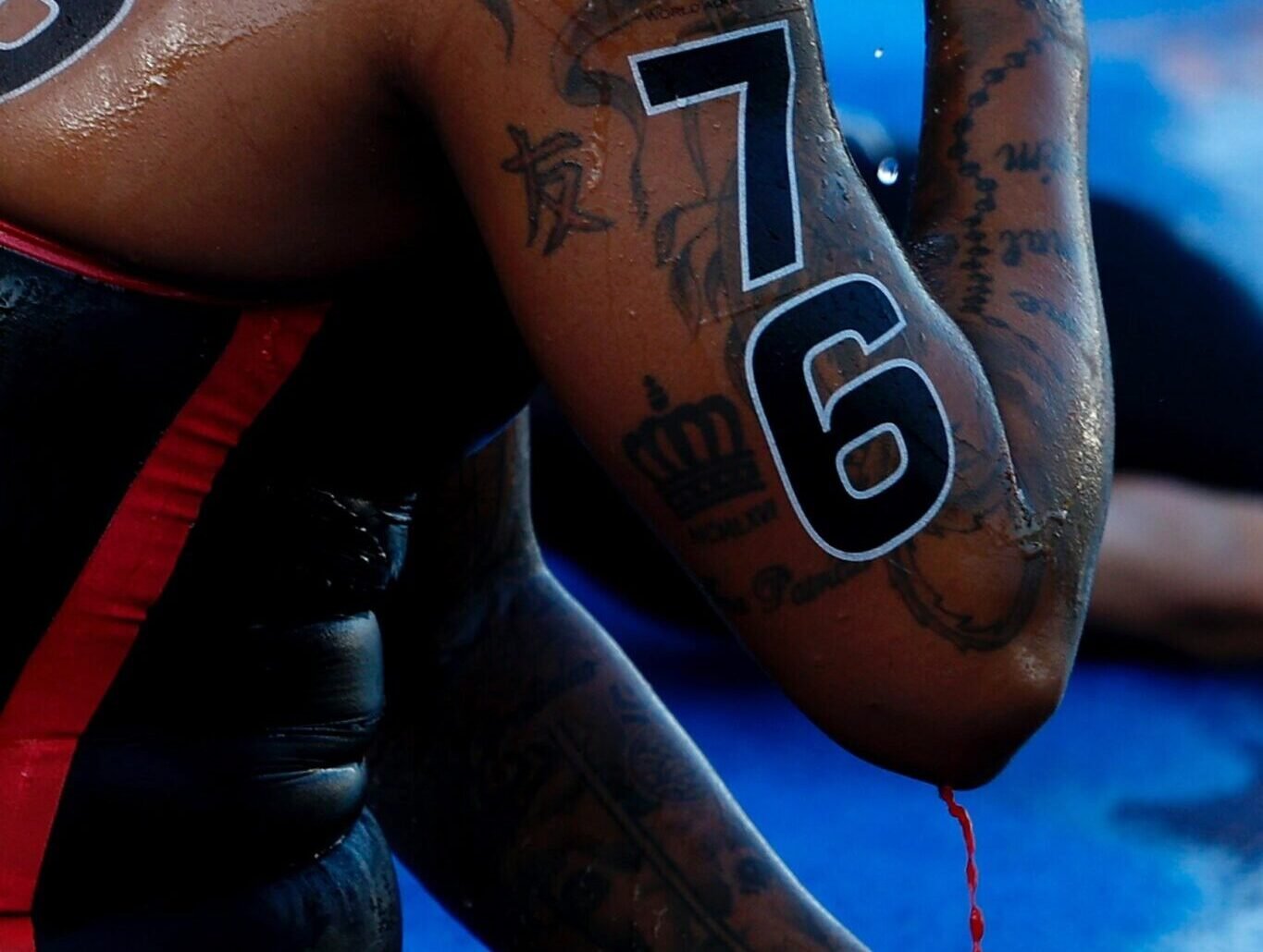 Sangue escorre pelo braço de Ana Marcela Cunha (foto: Satiro Sodré/AFP)