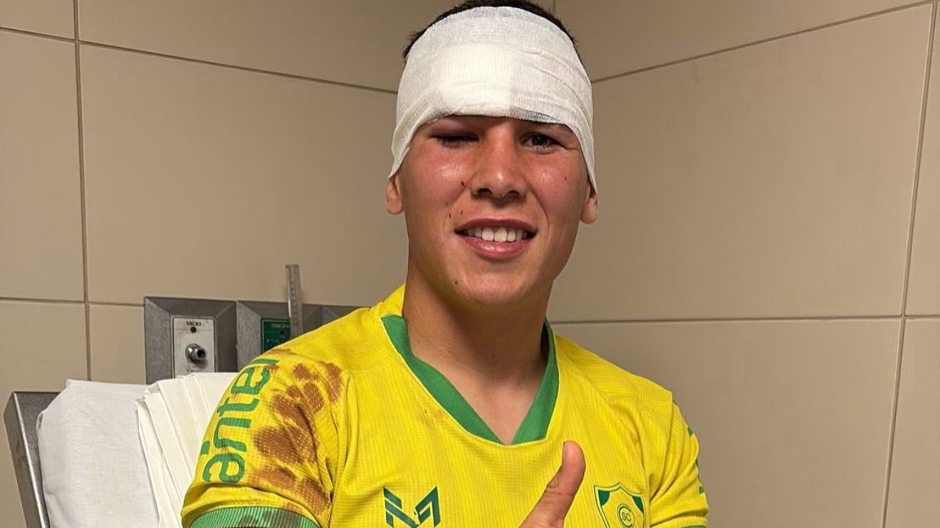 Agustín Rodríguez sofreu lesão mais grave, levou dez pontos e passará por cirurgia (foto: Cerrito/Divulgação)