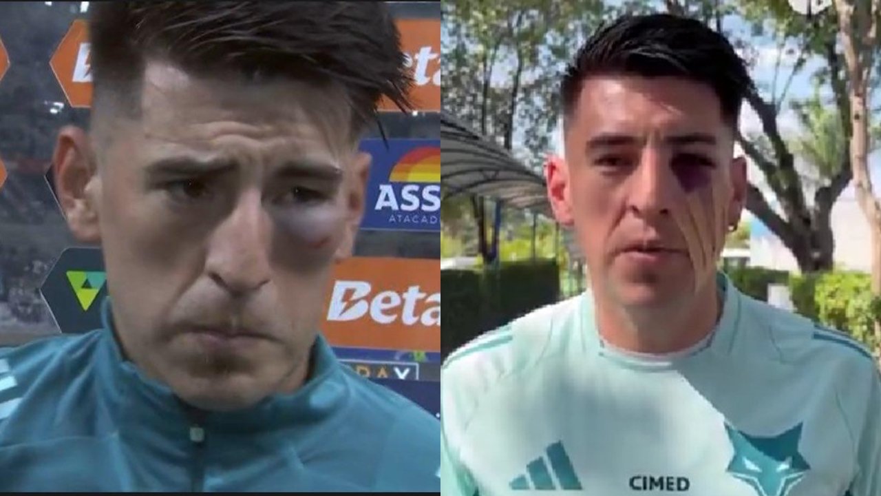 Rosto de Villalba com olho roxo (foto: Reprodução)