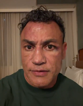 Popó se posicionou sobre briga na luta contra Wanderlei (foto: Reprodução)