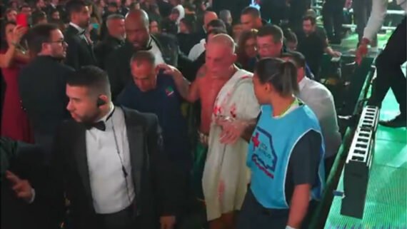 Wanderlei Silva ficou com o rosto cheio de hematomas (foto: Reprodução/TV Globo)