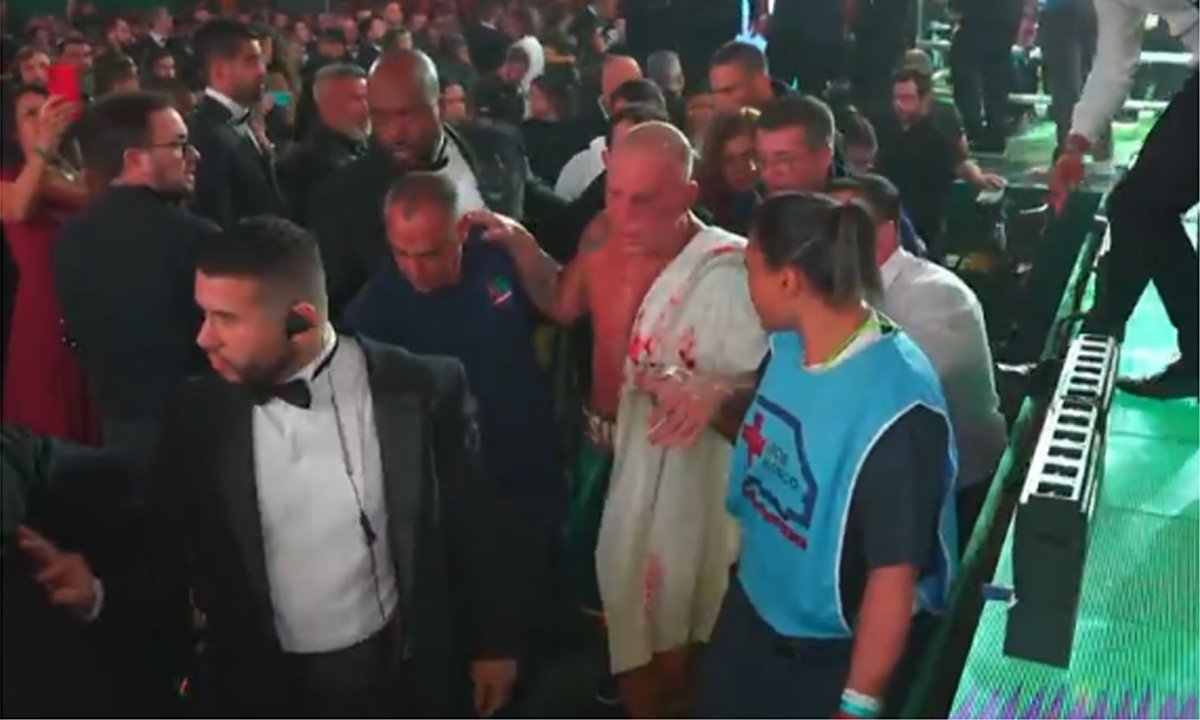 Wanderlei Silva ficou com o rosto cheio de hematomas (foto: Reprodução/TV Globo)