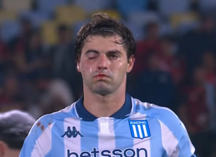 Sosa saiu da partida com o rosto inchado (foto: Reprodução)