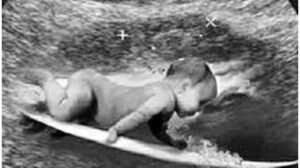 Imagem do post de Gabriel Medina no Instagram  - Crédito: 