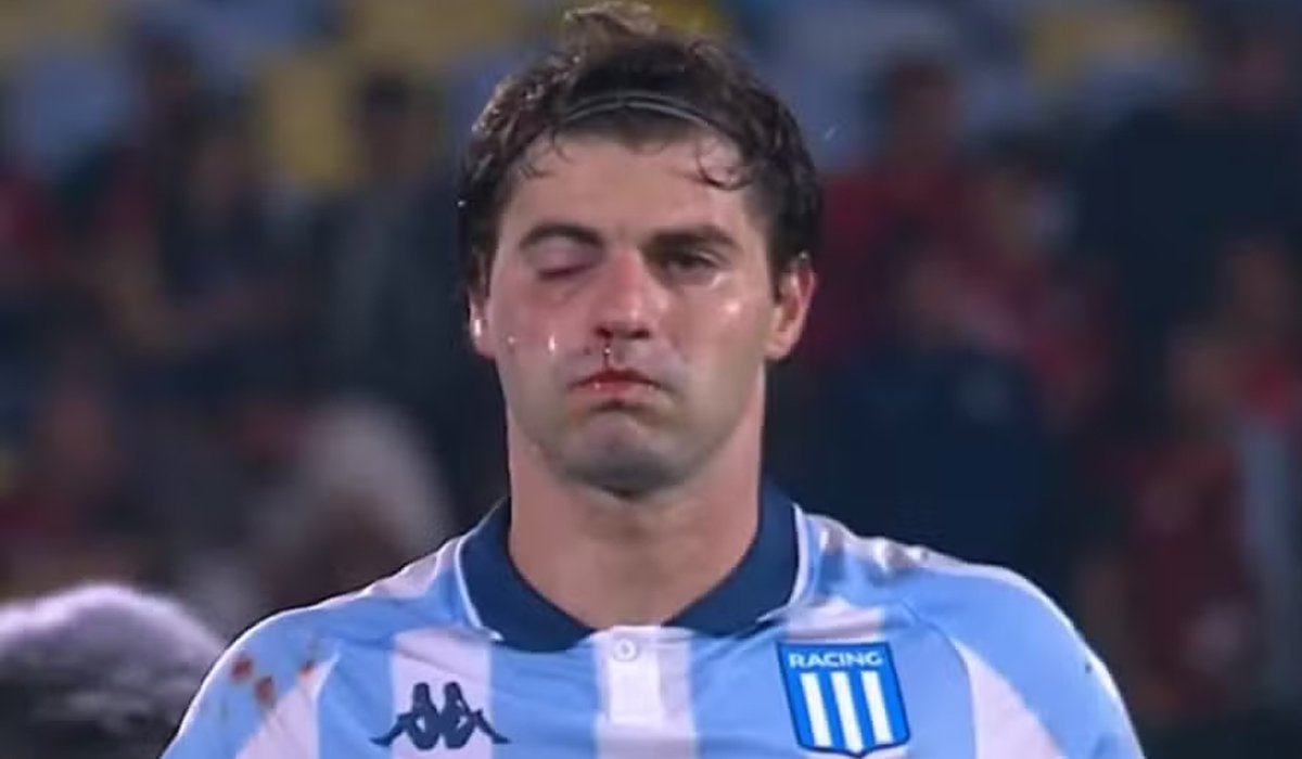 Sosa deixou o gramado do Maracanã com sangramento (foto: Reprodução)