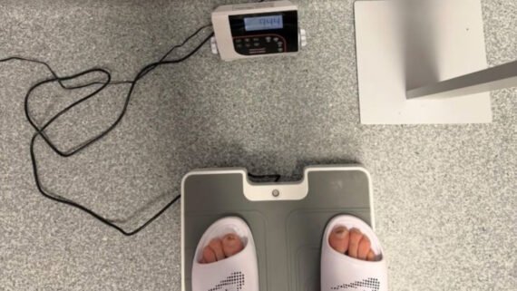 Foto de dois pés em cima de uma balança (foto: Reprodução/Haaland)